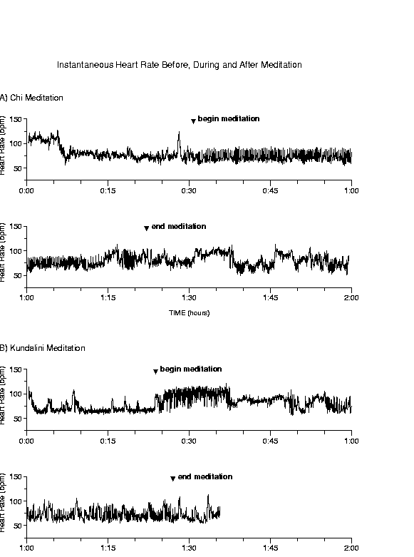 Instantaneous Heart Rate Time Series>
<BR>
<STRONG>Figure 1:</STRONG>
Representative instantaneous sinus rhythm heart rate time
series, before, during, and after meditation for two meditation
protocols: A) Chi meditation, and B) Kundalini meditation.  Notable
features of these time series from different subjects are i) the
complex variability of the fluctuations, and ii) the intermittent,
very prominent heart rate oscillations that correlated with
respiration.

<P>

<!--DIV ALIGN=
